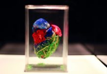Our body
