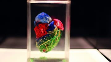 Our body
